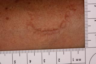 Original Image - Bite