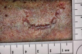 Filtered Image - Bite